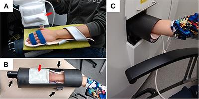 High-Resolution Peripheral Quantitative Computed Tomography for Bone Evaluation in Inflammatory <mark class="highlighted">Rheumatic Disease</mark>
